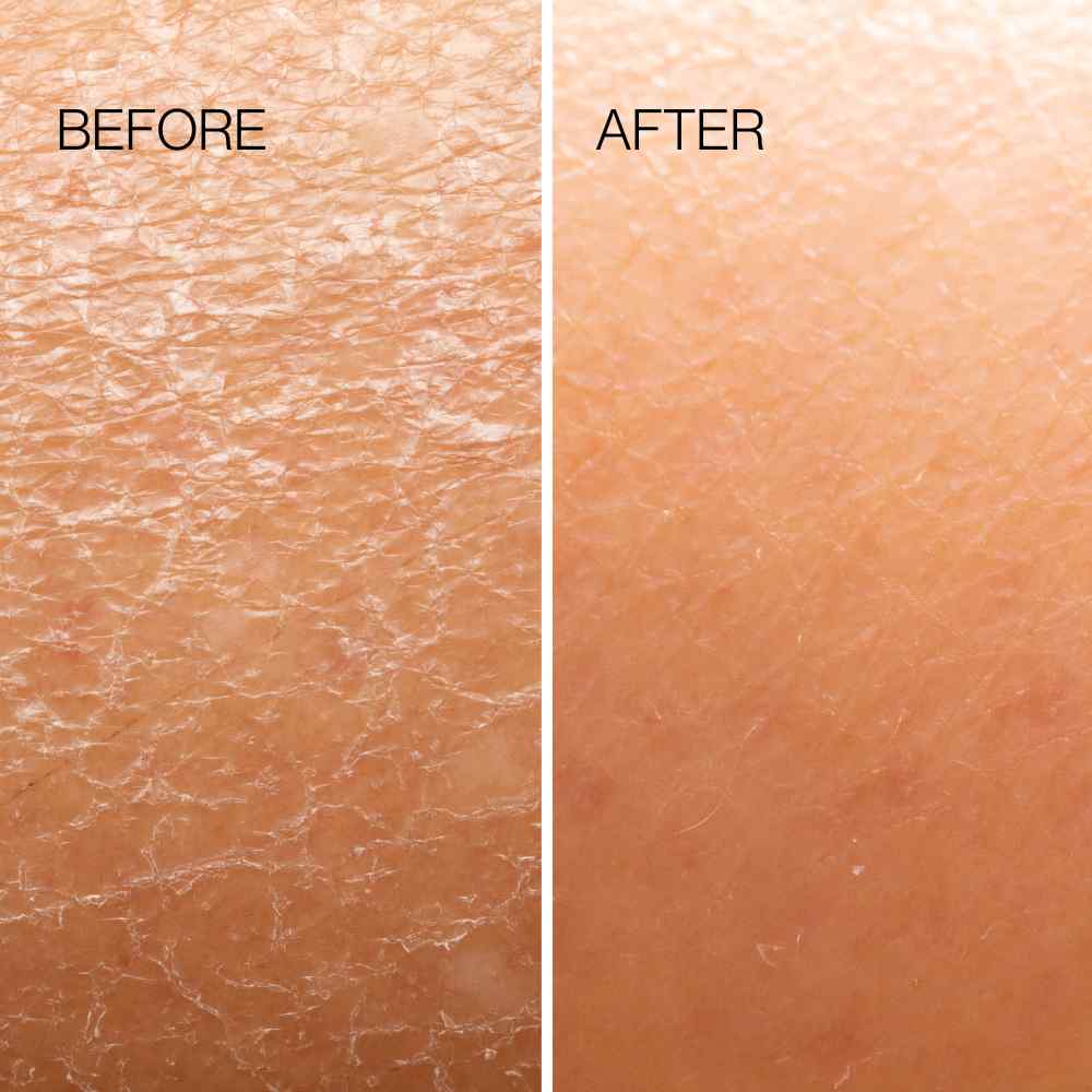 Body Plane Exfoliator